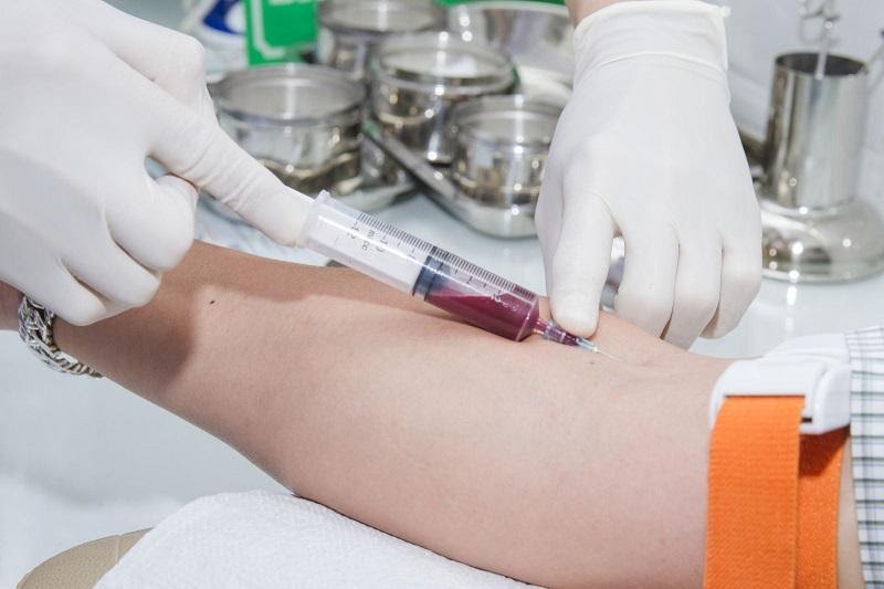 Xét nghiệm kiểm tra chỉ số GGT trong máu