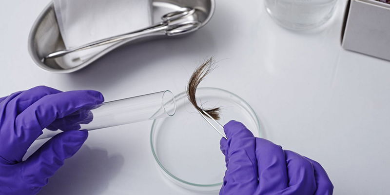 Xét nghiệm ADN qua mẫu tóc là hình thức được nhiều khách hàng ưu tiên hàng đầu