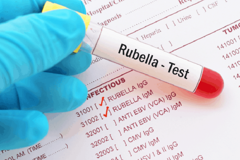 Mẫu xét nghiệm virus Rubella
