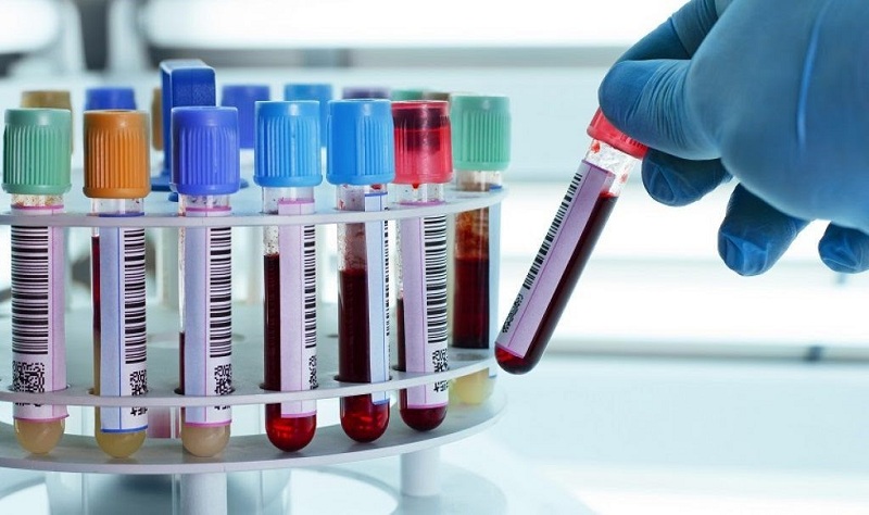 Xét nghiệm máu giúp chẩn đoán chính xác nhiều bệnh lý