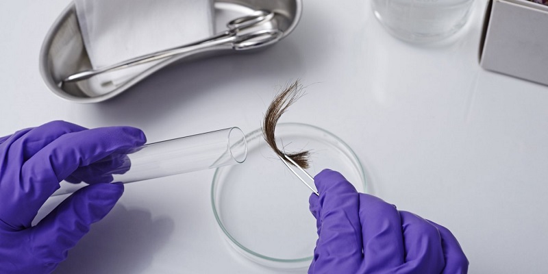 Sử dụng mẫu tóc còn nguyên chân tóc làm mẫu xét nghiệm ADN