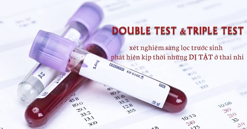 Xét nghiệm Double test giúp phát hiện nguy cơ mắc bệnh Down