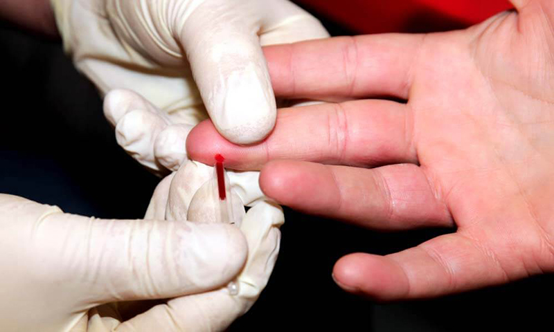 Xét nghiệm nhanh HIV là phương pháp dễ thực hiện và an toàn