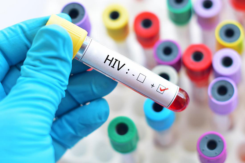 Hãy bình tĩnh và liên lạc với bác sĩ khi biết mình dương tính với HIV