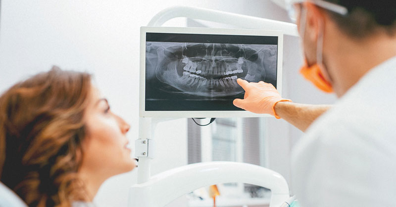 <a href='https://medlatec.vn/tin-tuc/medlatec--dia-chi-chup-xquang-rang-o-ha-noi-uy-tin-s154-n20066'  title ='chụp X quang răng'>chụp X quang răng</a>