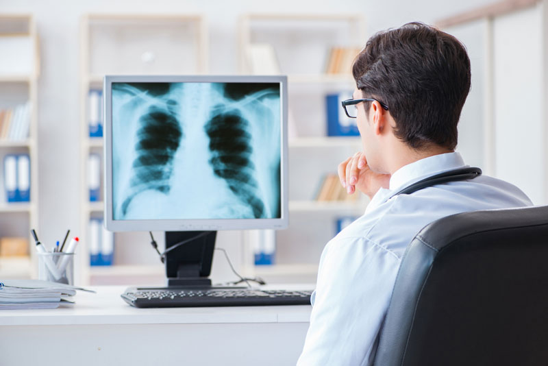 Chụp X-quang để phát hiện các dấu hiệu ung thư phổi