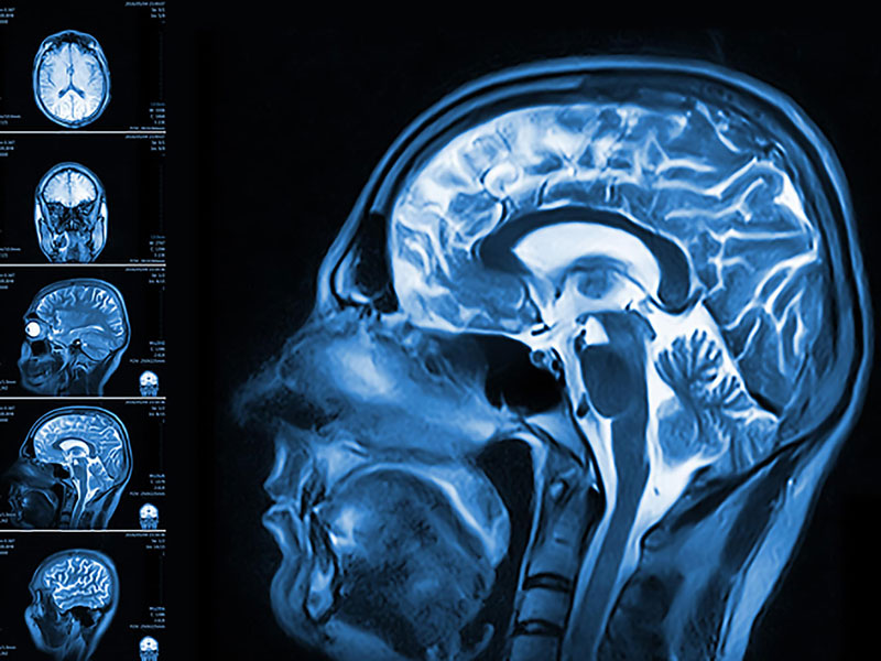 Hình ảnh hộp sọ và não bộ thu được nhờ kỹ thuật chụp cộng hưởng từ.