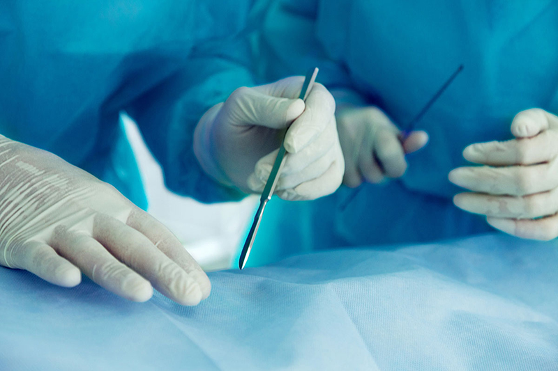 Bác sĩ tạo một vết mổ nhỏ trên bụng bệnh nhân để tiến hành nội soi