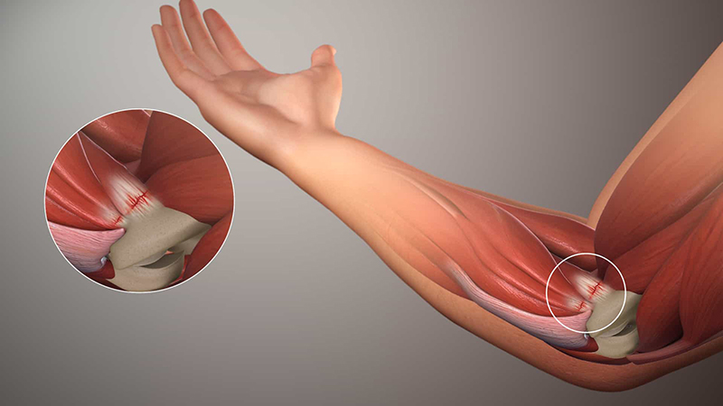 Hình ảnh khớp khuỷu và các gân, cơ vùng khuỷu