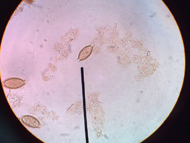 Hình ảnh trứng giun tóc trong phân dưới kính hiển vi