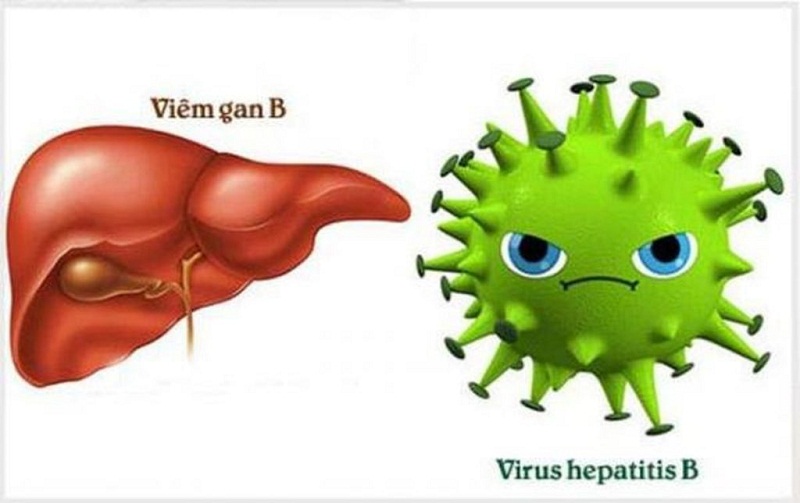 Bệnh lý viêm gan B do virus HBV gây ra