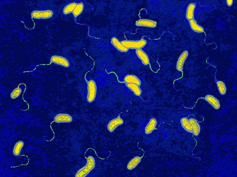 Hình ảnh vi khuẩn Vibrio Cholerae gây bệnh tả