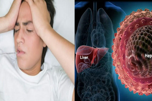 Mệt mỏi là một trong số  các biểu hiện của bệnh viêm gan 
