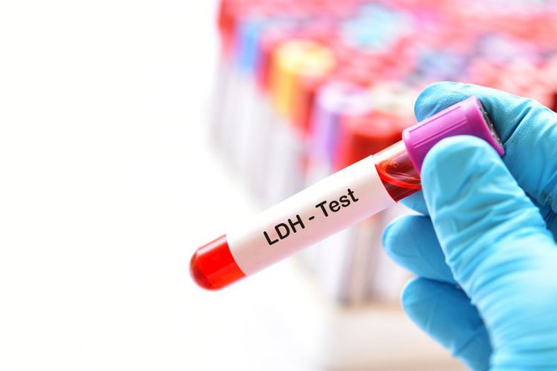 Hình 1: Xét nghiệm đo hàm lượng LDH toàn phần trong máu.