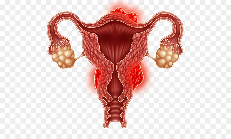 Nội soi giúp phát hiện và chẩn đoán các bệnh lý trong tử cung