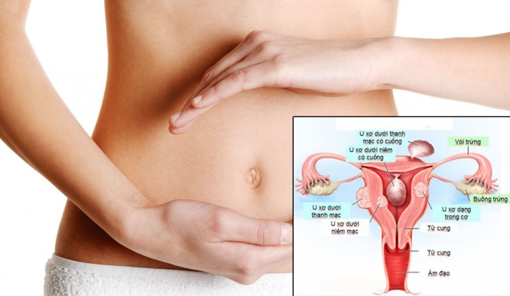 Những cơn đau ở phần bụng dưới có thể báo hiệu bạn đang mắc phải bệnh lý nào đó