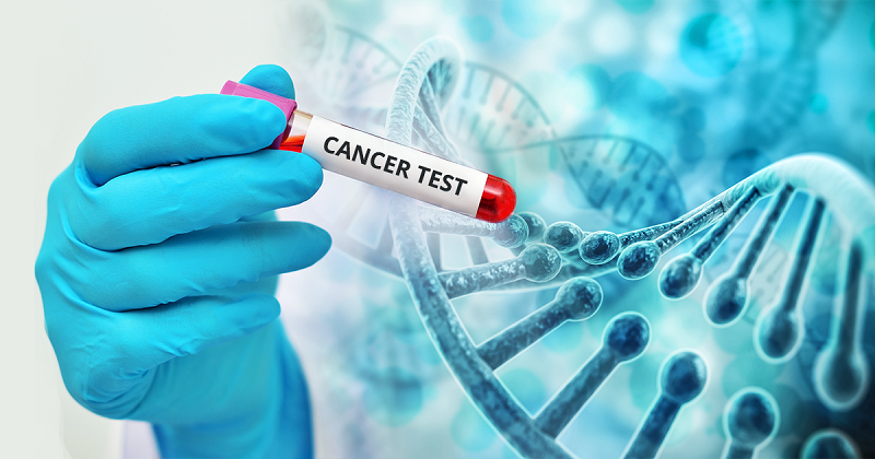 Israel đã nghiên cứu ra phương pháp xét nghiệm tầm soát ung thư phổi thông qua kiểm tra ADN của người bệnh. 