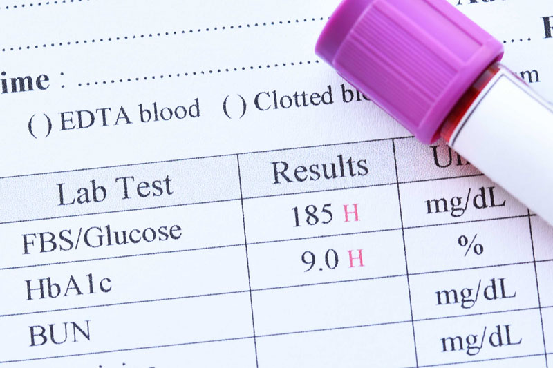Xét nghiệm HbA1c giúp phát hiện bạn có đang bị tiểu đường không.