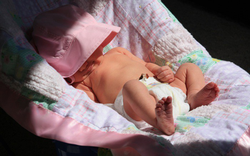 Phơi nắng là cách giảm vàng sinh lý mức độ nhẹ ở trẻ sơ sinh