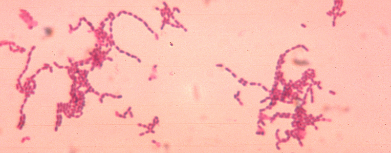 Hình 4: Vi khuẩn Peptostreptococcus