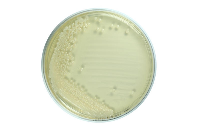 Hình ảnh khuẩn lạc nấm Candida sau nuôi cấy