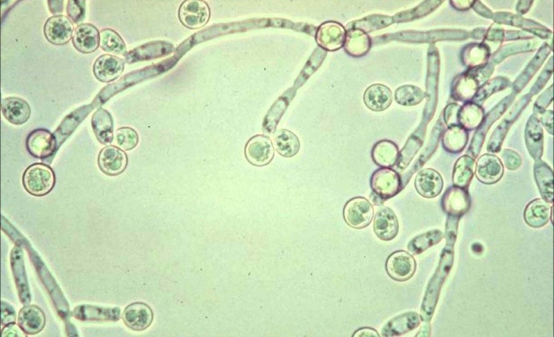 Hình ảnh nấm Candida