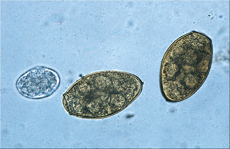 Hình 3: Hình ảnh trứng sán lá phổi