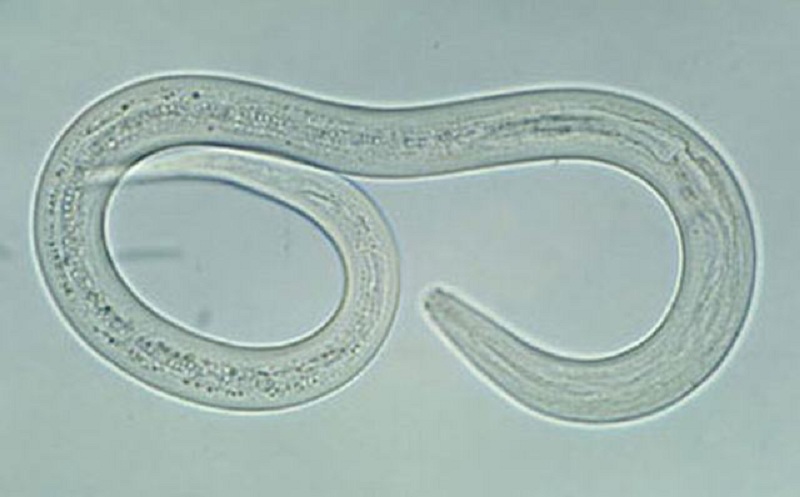 Hình ảnh ấu trùng Strongyloides stercoralis soi tươi phân