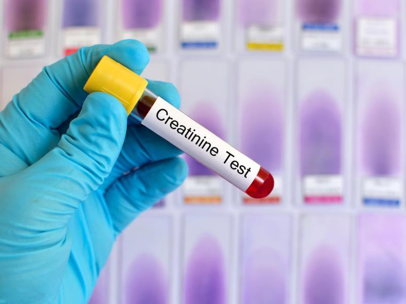 Xét nghiệm đo nồng độ Creatinin trong máu giúp chẩn đoán suy thận