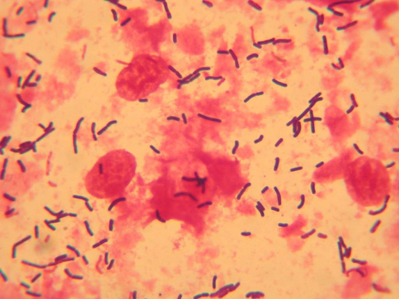 Hình ảnh nhuộm soi Lactobacillus trong dịch âm đạo của bệnh nhân bình thường