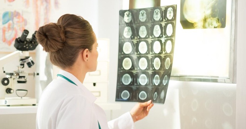 Chụp CT giúp phát hiện khối u hoặc các dị tật bẩm sinh vùng đầu, não
