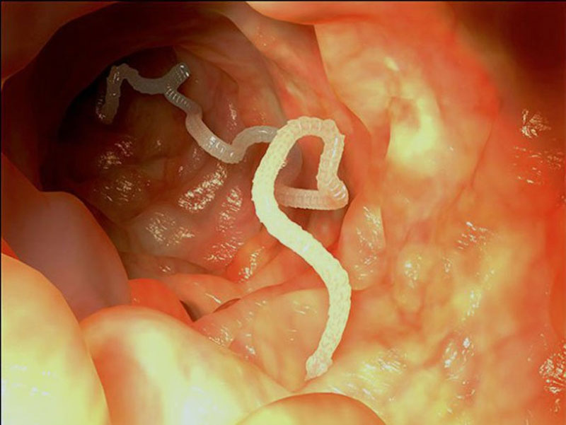 Hình ảnh sán ký sinh trong ruột của người