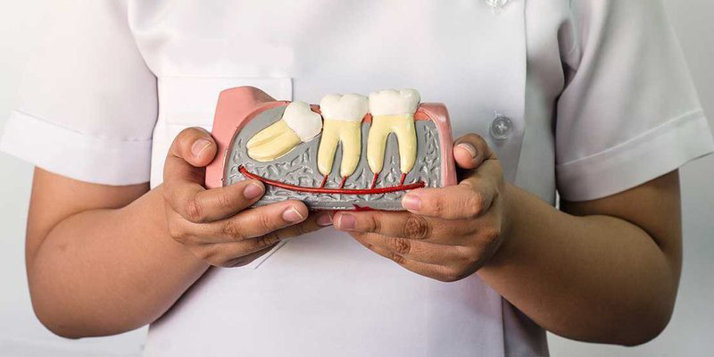 Răng khôn hay còn gọi là răng số 8 thường mọc ở vị trí trong cùng của cung hàm