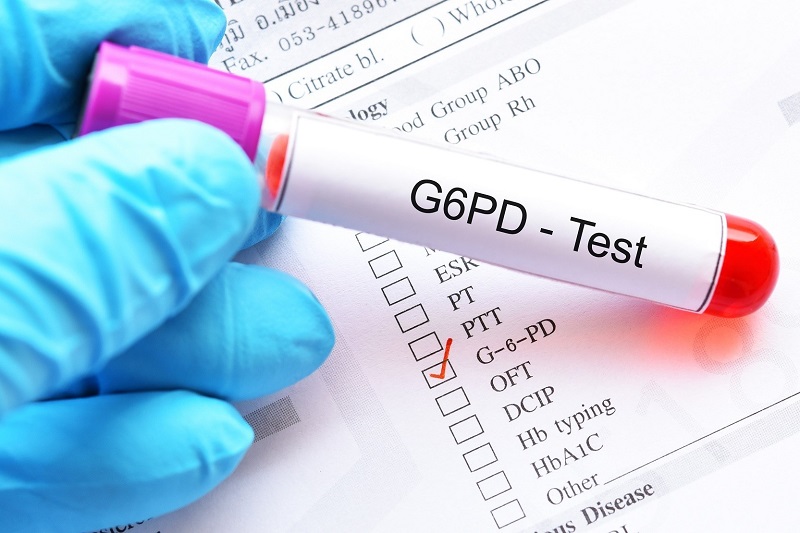 Xét nghiệm G6PD giúp phát hiện sớm bệnh ở trẻ