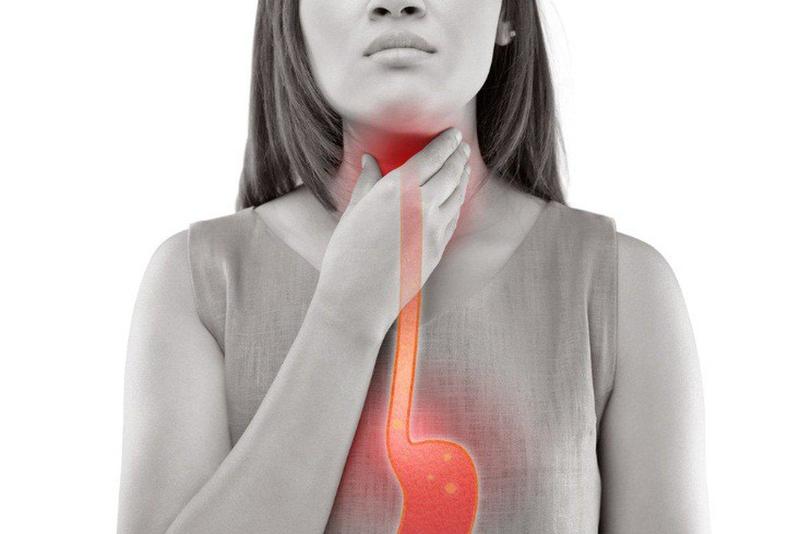 Trào ngược dạ dày thực quản cũng có thể gây ngứa họng ho