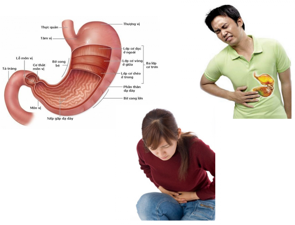 Một trong những bệnh về tiêu hóa thường gặp đó là viêm hang vị dạ dày.