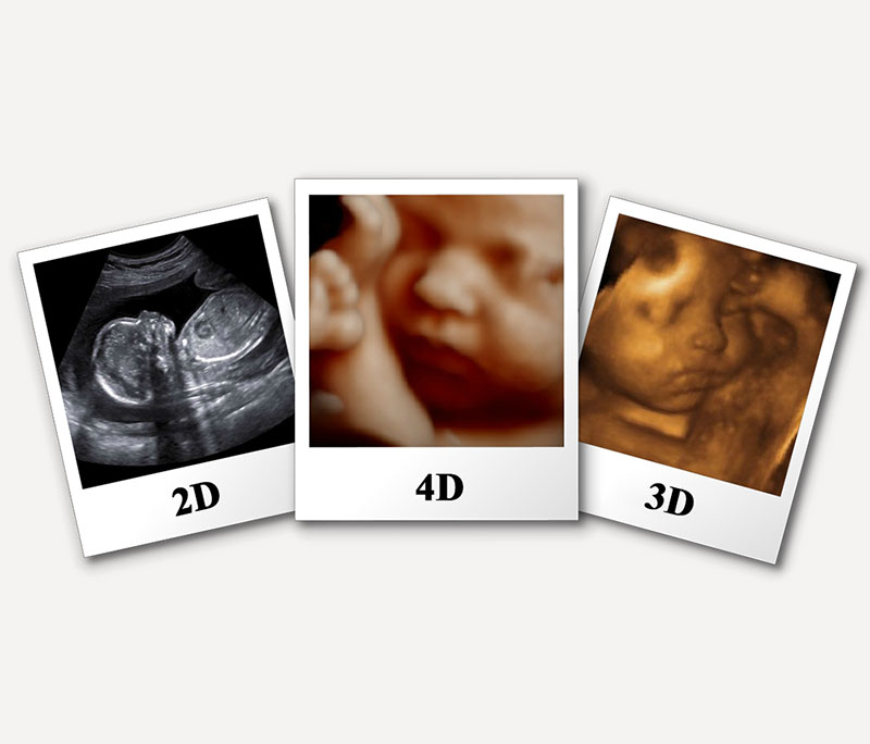 Siêu âm 3D cho phép mẹ bầu có thể quan sát được kỹ khuôn mặt và hình thái cơ thể của con
