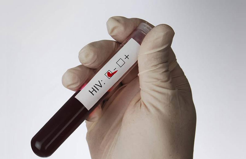 Xét nghiệm HIV bao lâu có kết quả