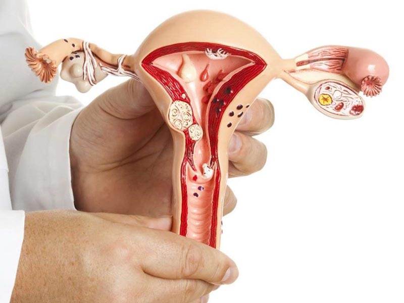 Dính buồng tử cung khi mang thai sẽ dần đến nhiều nguy cơ thai kỳ khác nhau