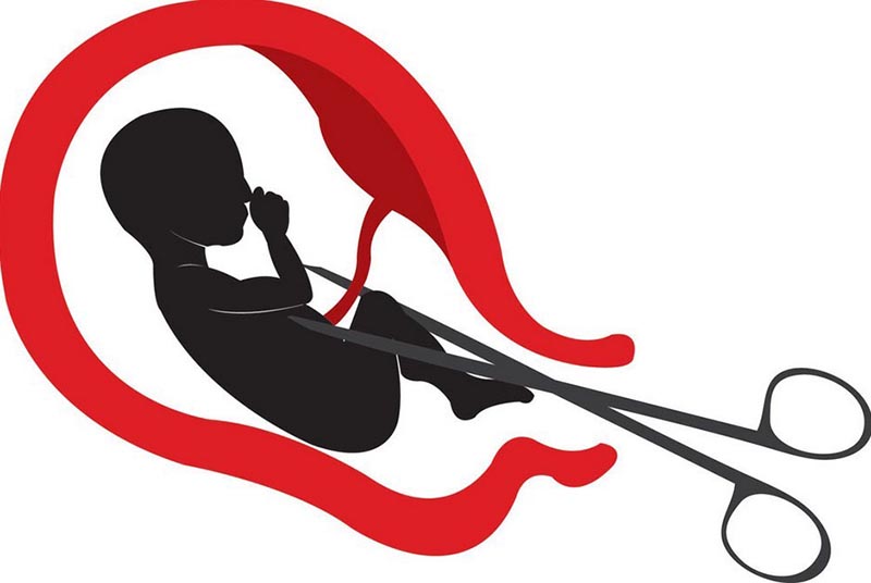 Việc nạo phá thai rất dễ gây ra tình trạng dính buồng tử cung