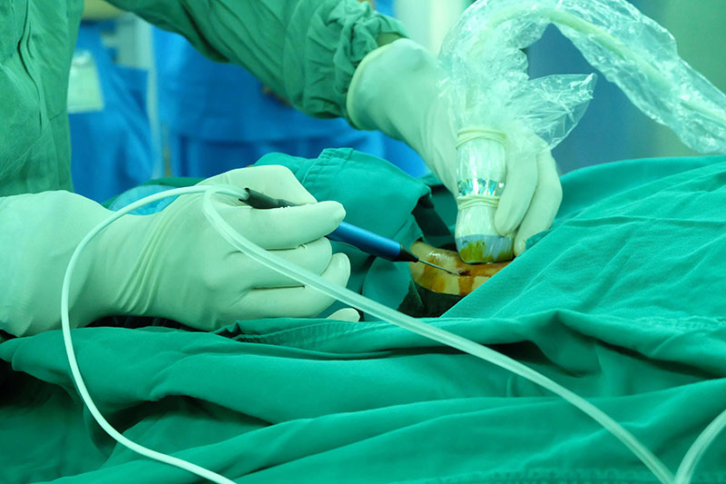Phẫu thuật cắt bỏ khối u hay bộ phận bị tổn thương