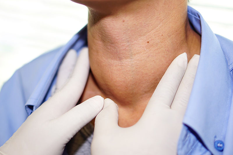Bệnh về tuyến giáp luôn đi kèm biểu hiện sưng ở cổ bướu cổ
