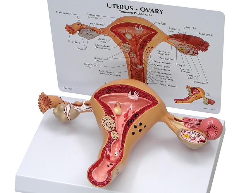 Mô hình minh họa tử cung và vòi trứng của nữ giới