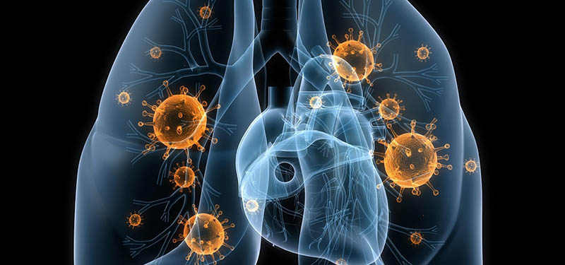 Tràn dịch màng phổi có lây không phụ thuộc vào tác nhân gây bệnh
