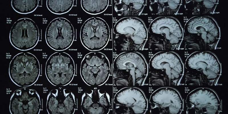 Kết quả chụp MRI não sắc nét, độ phân giải cao