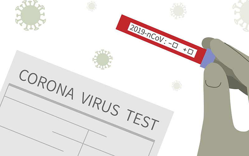 Các xét nghiệm phát hiện virus hoặc kháng thể có trong cơ thể là phương pháp xác định nhiễm Covid-19