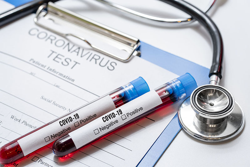 Kết quả test nhanh chỉ có giá trị sàng lọc mà không có giá trị khẳng định nhiễm SARS-CoV-2
