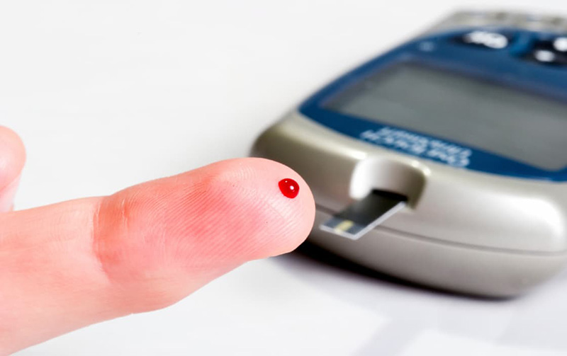 Xét nghiệm đường máu là một trong những xét nghiệm bạn nên thực hiện khi đi khám tổng quát