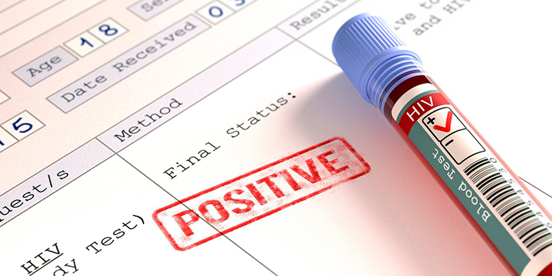 Kết quả xét nghiệm dương tính hay Positive, (+) có nghĩa là cơ thể bạn đã bị bệnh hoặc có nguy cơ cao bị bệnh