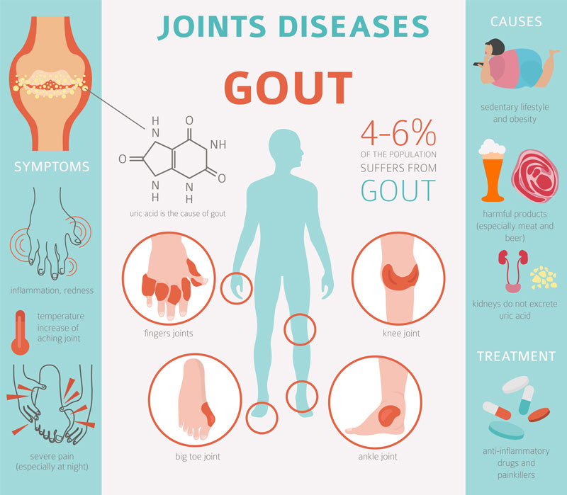 Chế độ dinh dưỡng thừa chất đạm là nguyên nhân gây ra bệnh gout